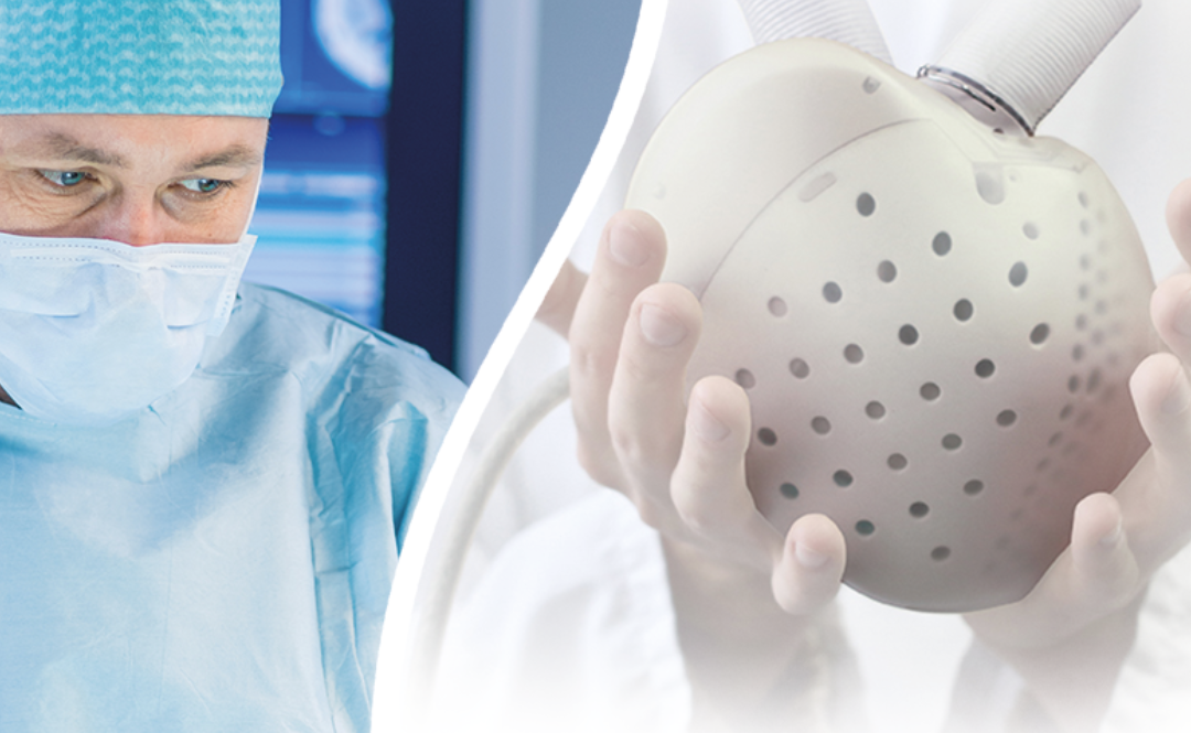 Sztuczne serce Carmat utrzyma przy życiu osoby oczekujące na przeszczep